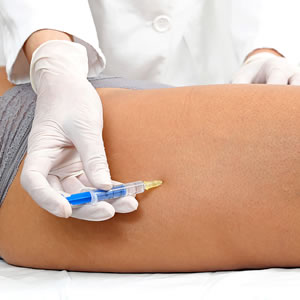 mesoterapia